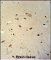 RRAGD Antibody  (Center)